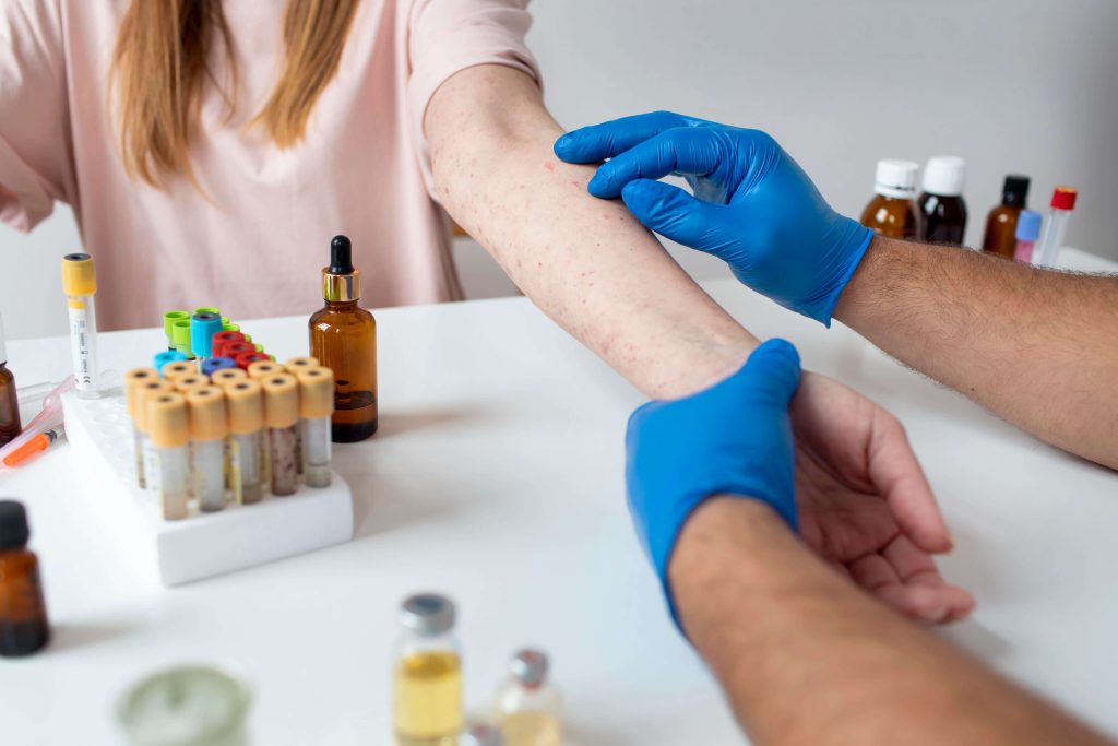 Médica Especialista em Testes Alérgicos no Rio de Janeiro