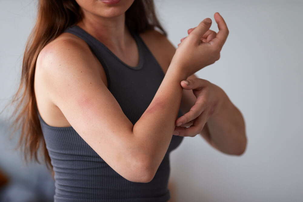 Médica Especialista em Dermatite e Imunoterapia no Rio de Janeiro
